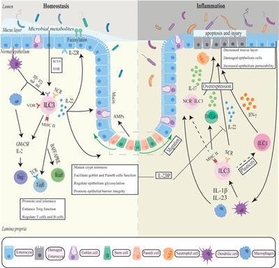 The role of group 3 innate lymphoid cell in intestinal disease